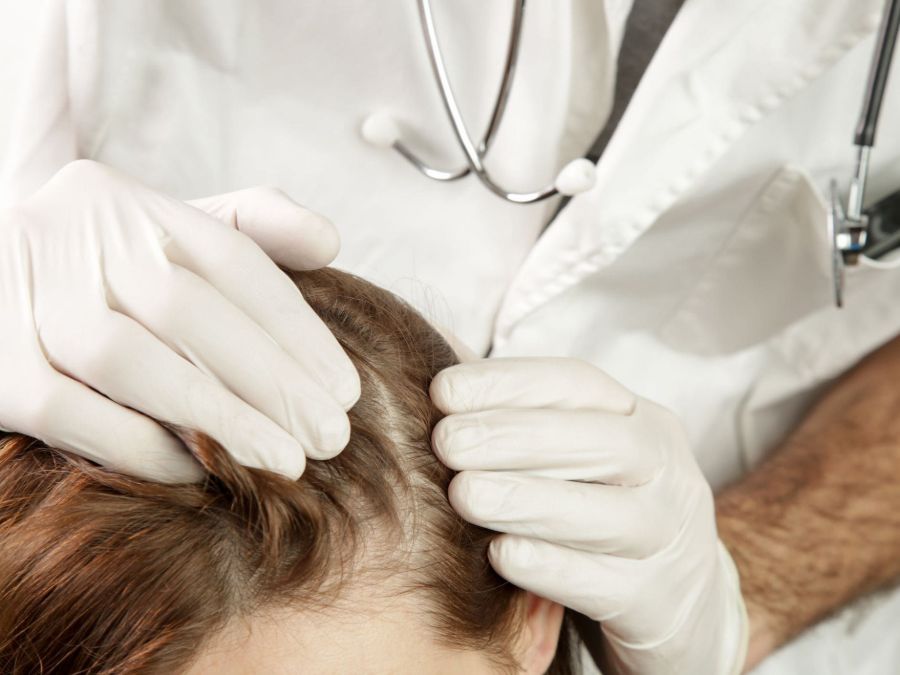 Nizoral 2% Shampoo: Everything You Need To Know